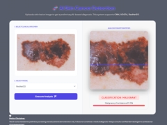 Đồ án Học Máy - Xử lý ảnh để tài phát hiện ung thư da (Full báo cáo + ppt)