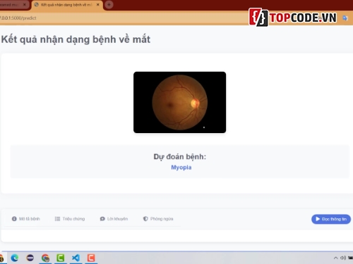 Code đồ án,Code python,full code + báo cáo,Deep Learning,Nhận Biết Bệnh Về Mắt,code giá rẻ