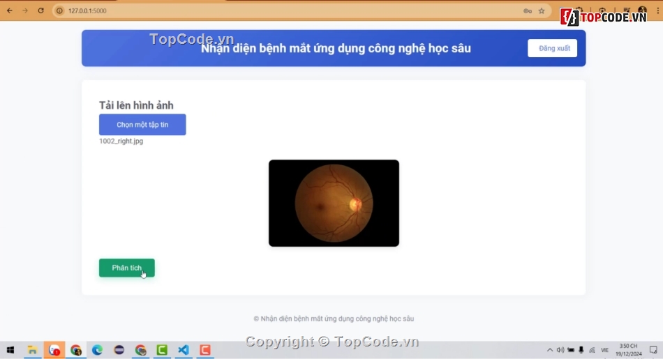 Code đồ án,Code python,full code + báo cáo,Deep Learning,Nhận Biết Bệnh Về Mắt,code giá rẻ