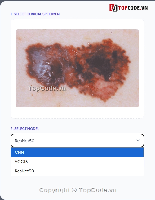 Xử lý ảnh,báo cáo + slide,Học máy,Machine Learning,Ung thư da,Skin Classification