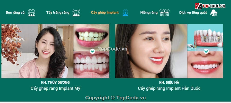 Sharecode website nha khoa,nha khoa,full code nha khoa,website nha khoa,code nha khoa,chothemewp