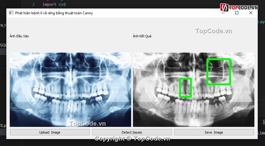 Ứng dụng thuật toán,Xử lý ảnh,python,thuật toán canny,xử lí ảnh python,thuật toán kmean